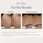 FR Age Adaptive Clearing Serum