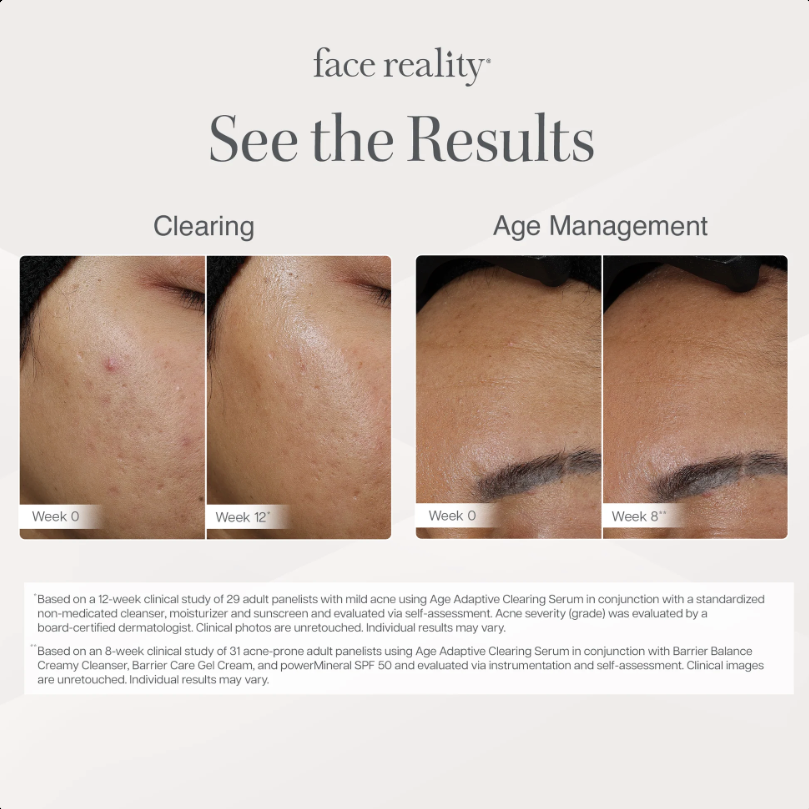 FR Age Adaptive Clearing Serum